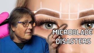 Before  Removing Microblade  Eyebrows With Lasers Watch This : A Doctor Explains