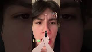 ИТАЛЬЯНСКИЕ ЖИВОТНЫЕ ПРОТИВ ДАЧНИКА