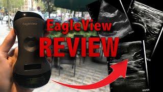 EagleView Ultrasound Complete Review | with 12% discount code "POCUS12"