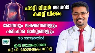 ഫാറ്റി ലിവർ അഥവാ 'കരള് വീക്കം'  സുഖപ്പെടുത്താനുള്ള വഴികൾ ഇതാ Fatty Liver Malayalam Dr Manoj Johnson