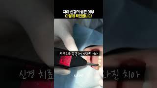 ️ 치아 신경의 생존 여부 이렇게 확인합니다