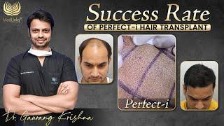 Success Rate of Perfect-i Hair Transplant Technique | Best Hair Transplant in India | Medlinks