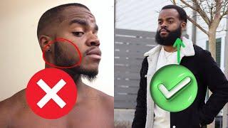 5 Tips I Used To Grow A FULL BEARD | Maximize Beard Growth & Thickness | Mens Grooming Methods