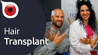 My Experience with Istanbul Vita from Albania | Hair Transplant in Istanbul / Turkey