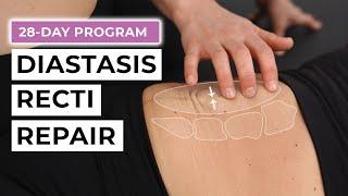 28-Day Diastasis Recti Repair Program (FREE Challenge!)