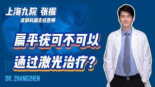 扁平疣可不可以通过激光治疗？