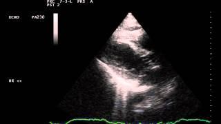 Case of the Month # 1 - Cardiac