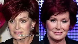 Part 2 - Celebrity Transformations: Before and After Plastic Surgery