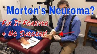 Morton's Neuroma Fix it Forever