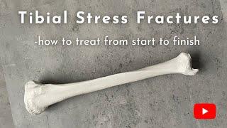 Tibial Stress Fractures | Causes, Diagnosis, and Treatment