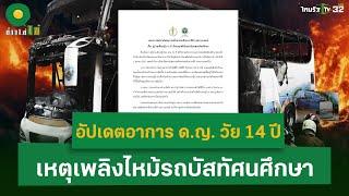 อัปเดตอาการ ด.ญ. วัย 14 ปี เหตุเพลิงไหม้รถบัสทัศนศึกษา อาการทั่วไปดีขึ้น | 4 ต.ค. 67 | ข่าวใส่ไข่