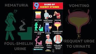 9 Signs of Kidney Stones You Shouldn’t Ignore | How to Know If You Have Kidney Stones