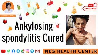 Ankylosing spondylitis & other 17 diseases  By Dr. Zarna Patel (NDS) | New Diet System