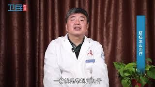 【普通外科】脐疝怎么治疗？