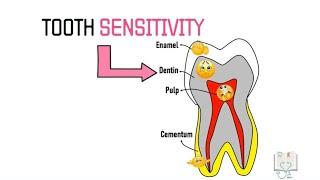 Theories of Dentin Sensitivity/ Hypersensitivity