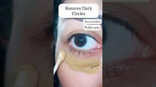 3 Nights Remove Dark Circles/Eye Wrinkles/puffy eyes| Young Eyes #darkcircles #skincare #shorts