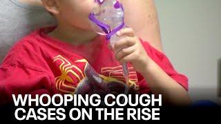 Whooping cough in Wisconsin; cases much higher than previous years | FOX6 News Milwaukee