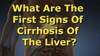 What Are The First Signs Of Cirrhosis Of The Liver?