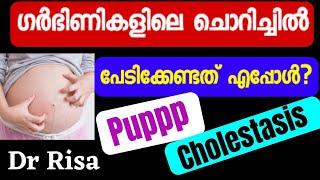 Pregnancy Time Skin Itching Malayalam | Puppp rash | Cholestasis