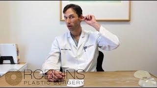 OTOPLASTY (EAR) - Top Rated Nashville, TN Plastic Surgeon Dr. Chad Robbins - Video Vlog