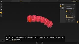 How To Prepare a Print Job for Lucitone Digital Print Dentures for Primeprint™ Solution