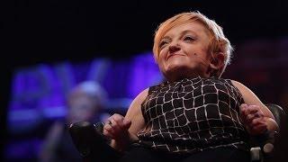 I'm not your inspiration, thank you very much | Stella Young