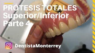 PASOS Prácticos #PrótesisTotalesParte4 Prueba dientes/Ajustes/PrótesisTerminada #DentaduraCompleta