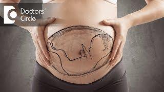 Can one alter fetal position from tranverse position in 32 weeks of gestation?- Dr. Nupur Sood