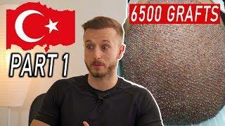 I Wish I knew about Hair Transplant in Turkey! PART 1