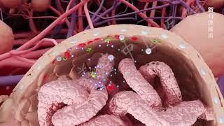 glomerulonephritis