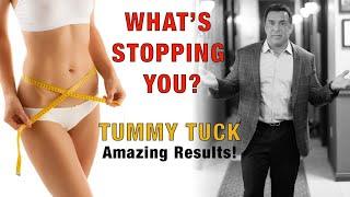 Dr. Stile - Tummy Tuck Surgery Part 3