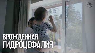 Врожденная гидроцефалия, лечение и реабилитация в РЦ Три сестры