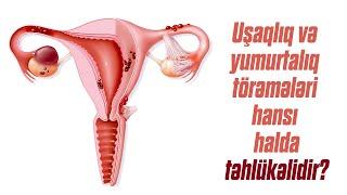 Uşaqlıq və yumurtalıq törəmələri hansı halda təhlükəlidir? Cərrah mama ginekoloq Aytən Nəcəfəliyeva