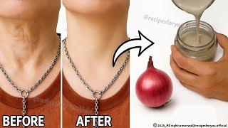  1 Onion is A Million Times Stronger Than Botox!  Instantly Eliminates Wrinkles and Fine Lines 