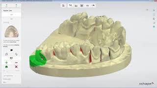 3DBioCAD - 3Shape Dental System Adaptive Scanning