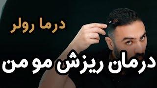 همه چیز درباره درما رولر , موثرترین روش درمان ریزش مویی که من انجام دارم میدم  (۳۷۲)