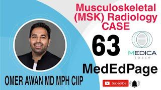 Musculoskeletal (MSK) Radiology CASE #63 @medicaspacededicatedmedica1576
