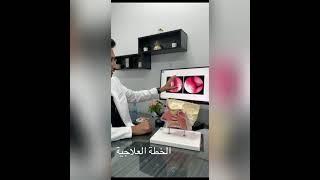 تضخم القرنيات حساسية الانف تصغير القرنيات الانفيه