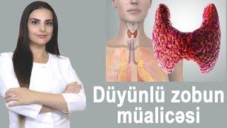 Düyünlü zobun müalicəsi