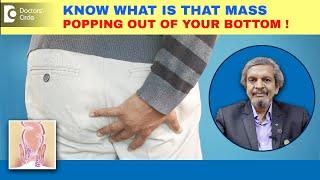 Lump or mass popping out of bottom/Anus| Hemorrhoid,Polyp,Cancer?-Dr.Rajasekhar M R| Doctors' Circle