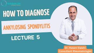 Ankylosing spondylitis series: Video 5: Diagnosis of ankylosing spondylitis. Hatem Eleishi