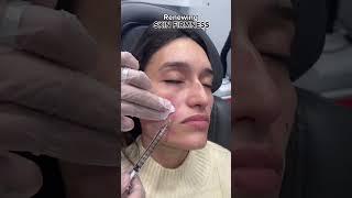 What is SCULPTRA for? | Dr. Medispa