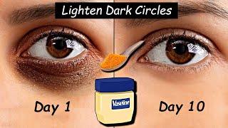 i Apply Vaseline + Turmeric around my Eyes & Removed DARK CIRCLES & Eye Wrinkles - No Under Eye bags