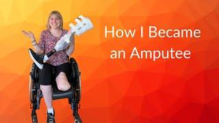 How I Lost My Leg Amputee Story and Gratitude 5 Years Later