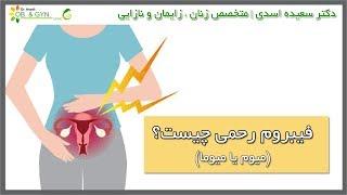 فیبروم رحمی چیست؟ | پاسخ دکتر سعیده اسدی | متخصص زنان٬ زایمان و نازایی