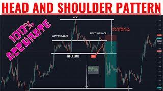 HEAD AND SHOULDER PATTERN. (Trading Strategy)