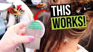 Lice Combing Techniques - How to Comb Lice out of Your Hair