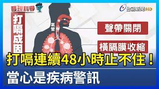 打嗝連續48小時止不住! 當心是疾病警訊【發現科學】