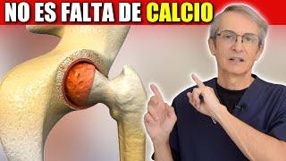  La OSTEOPOROSIS  no es una DEFICIENCIA de CALCIO - Remedios Osteoporosis