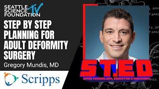 Step by Step Planning for Adult Spinal Deformity Surgery – Greg Mundis, MD